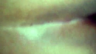 从我屁眼里拆掉所有缝针？