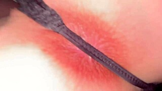 I've heard some girls worry their pigmented anal area looks dirty even if clean, but is that accurate?